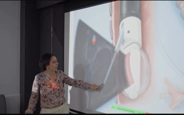 Introducen en RD tecnología para diagnóstico cáncer pulmón