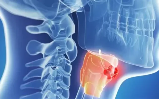 Abril: mes de concienciación sobre tumores cabeza y cuello
