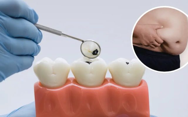 Pérdidas dentales inciden en el aumento de peso, según estudio