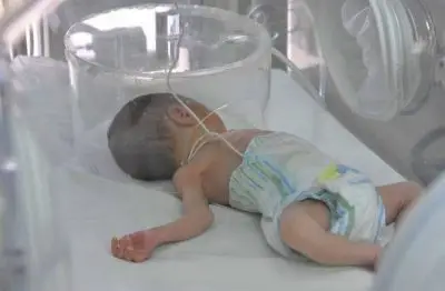 RD reduce 30,1 % mortalidad neonatal hospitales públicos